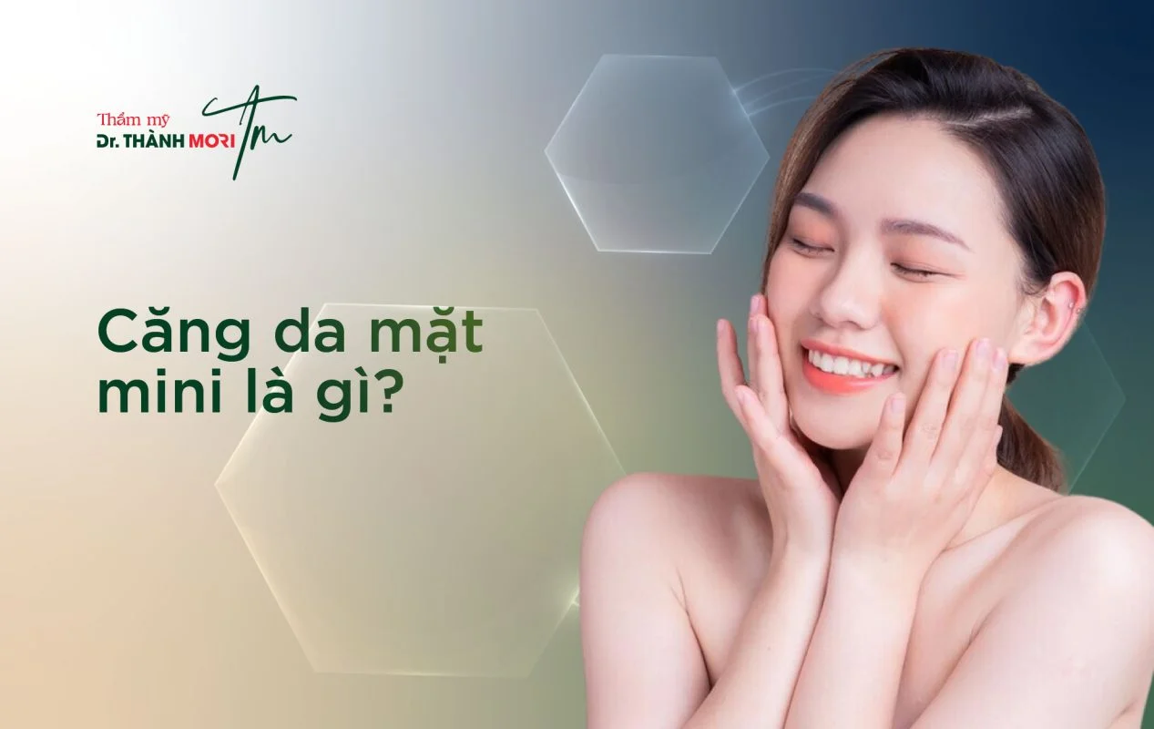 căng da mặt mini là gì