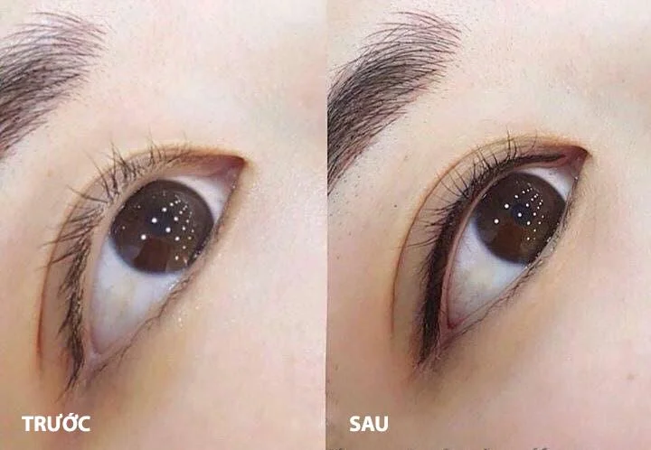 Phun xăm thẩm mỹ
