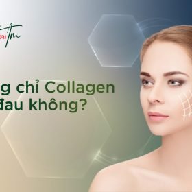 Căng chỉ Collagen có đau không?
