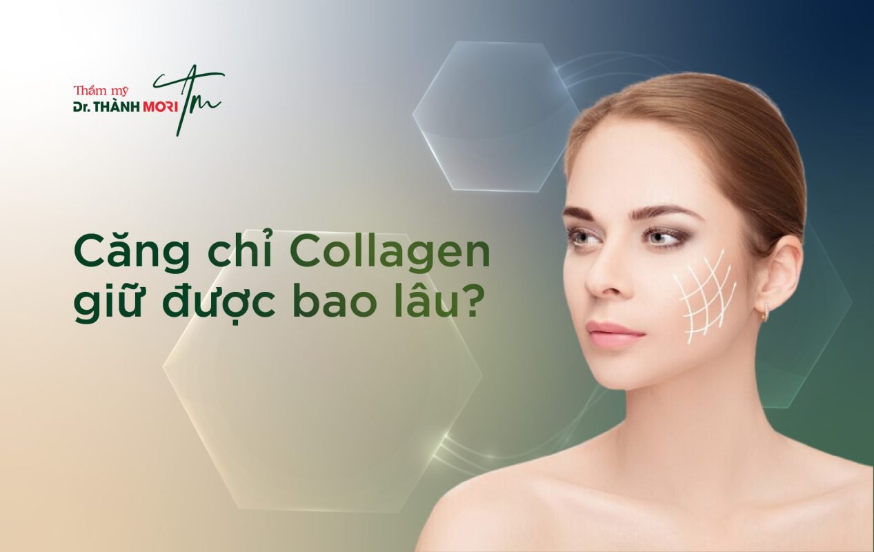 căng chỉ collagen giữ được bao lâu-19