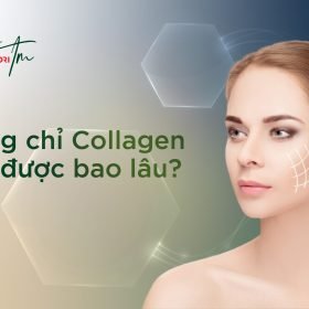 căng chỉ collagen giữ được bao lâu-19