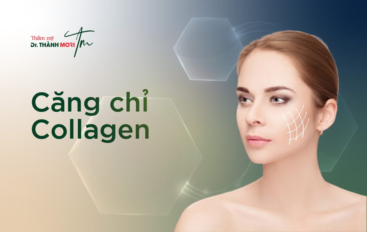 căng chỉ collagen là gì