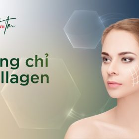 căng chỉ collagen là gì